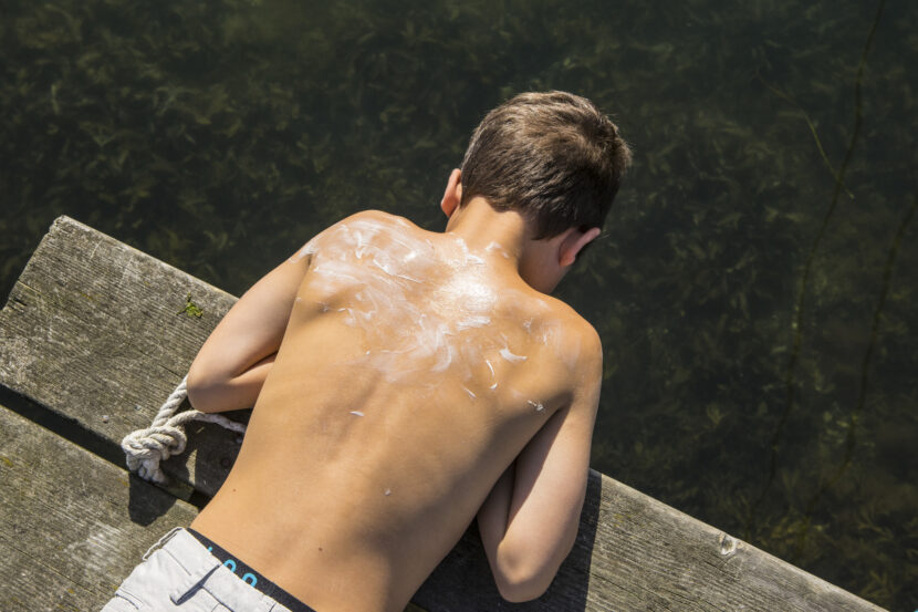 Oslo 20160803.Gutt ligger på brygga med solkrem på ryggen. Foto: Thomas Brun / NTB NB! MODELLKLARERT