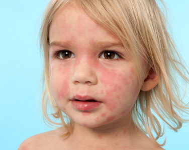 Elveblest. (Foto: Istock / Dicical.)
