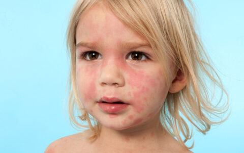 Elveblest. (Foto: Istock / Dicical.)
