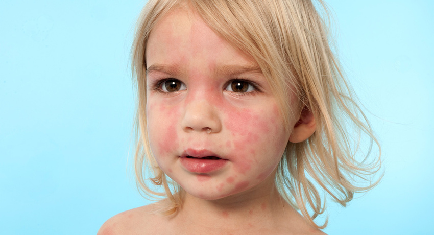 Elveblest. (Foto: Istock / Dicical.)